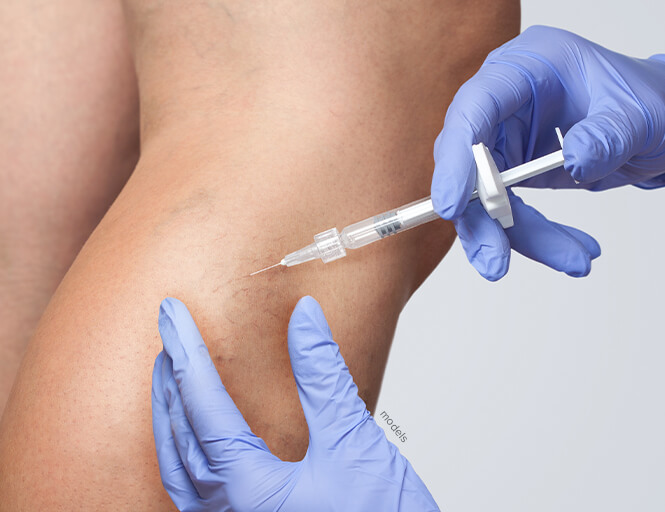 Leg being injected with a syringe.
