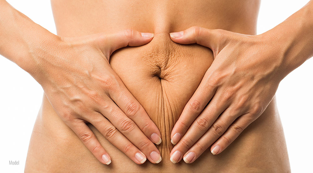 A woman squeezes the loose skin on her belly.
