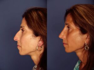 Before and After Image