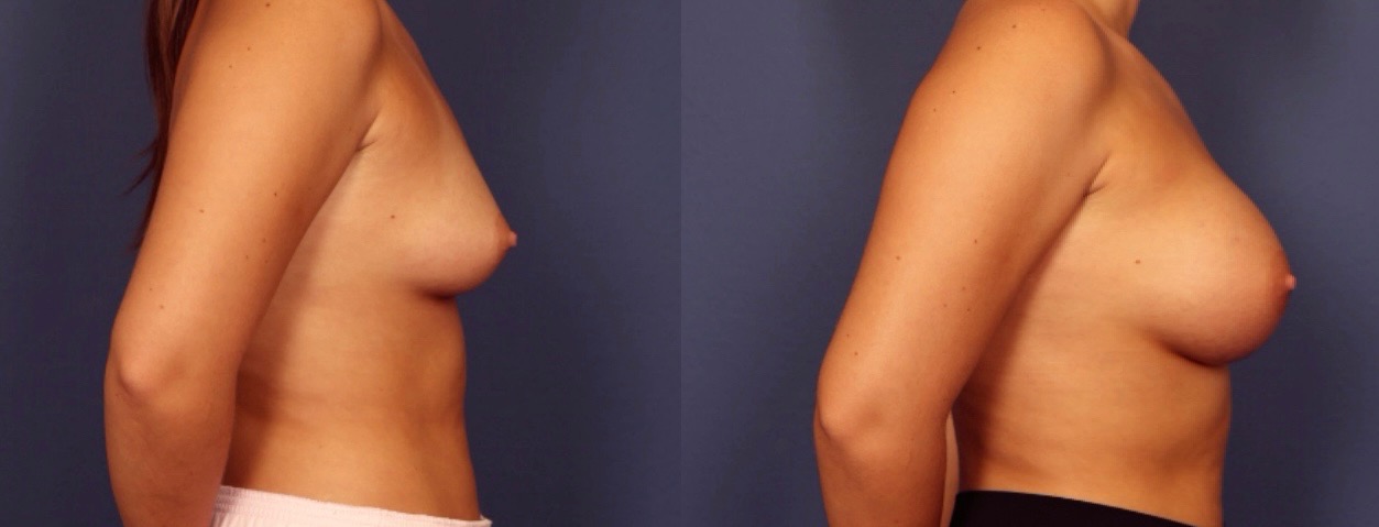 Before and After Image