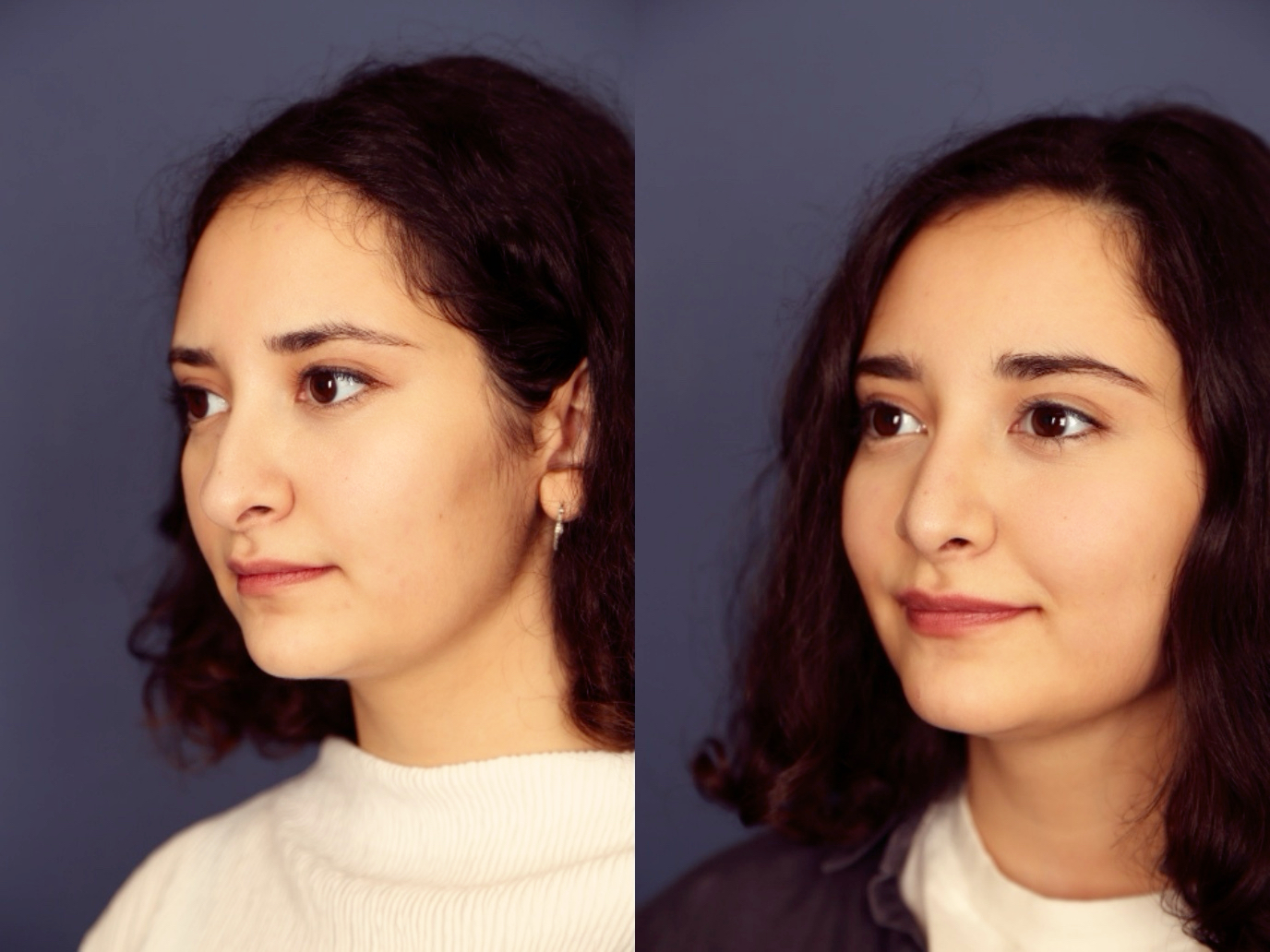 Before and After Image