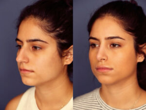 Before and After Image