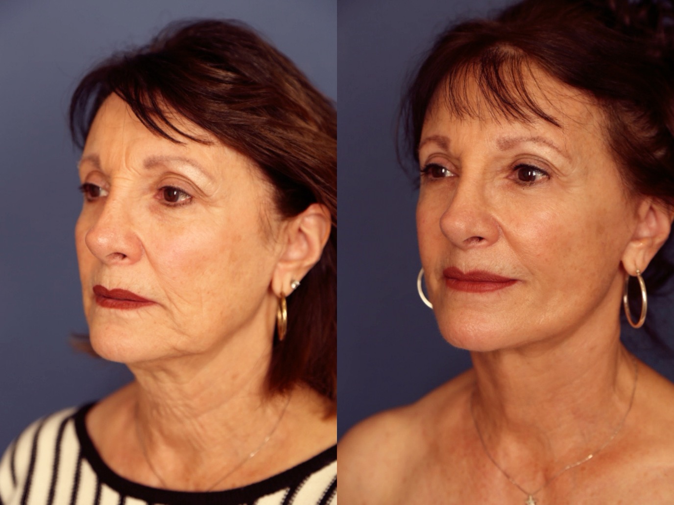 Before and After Image