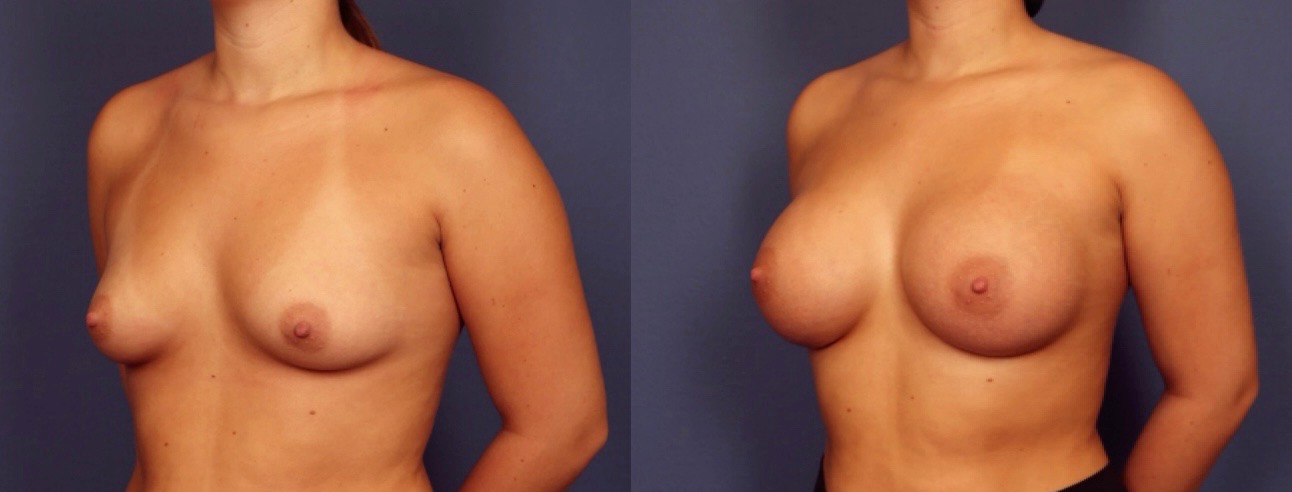 Before and After Image