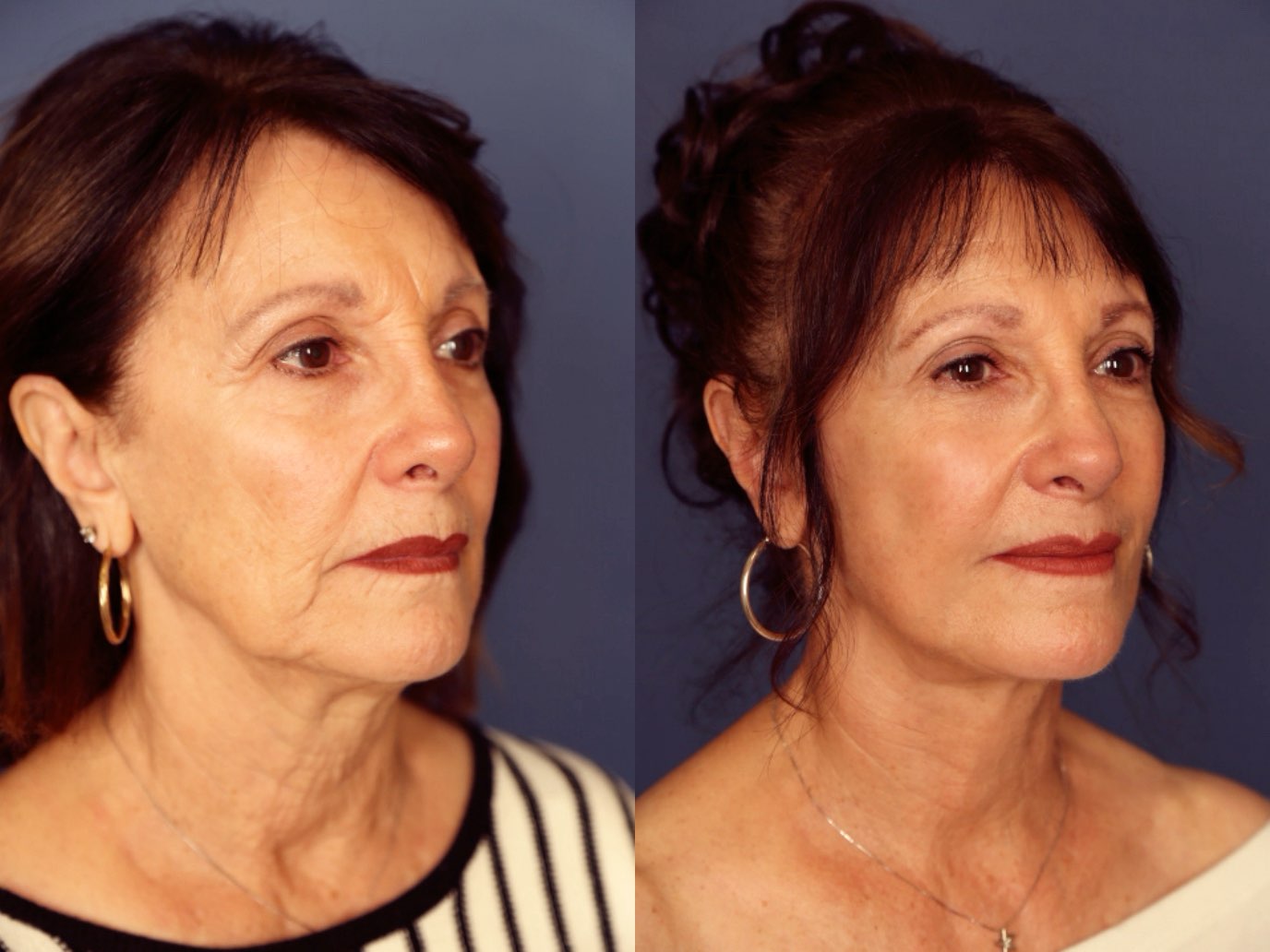 Before and After Image