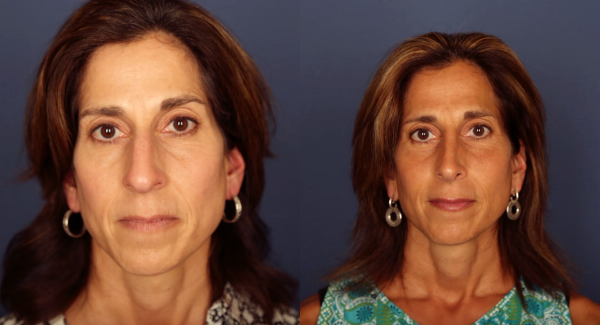 Before and After Image