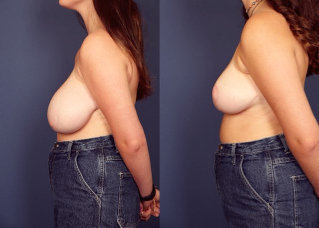 Before and After Image