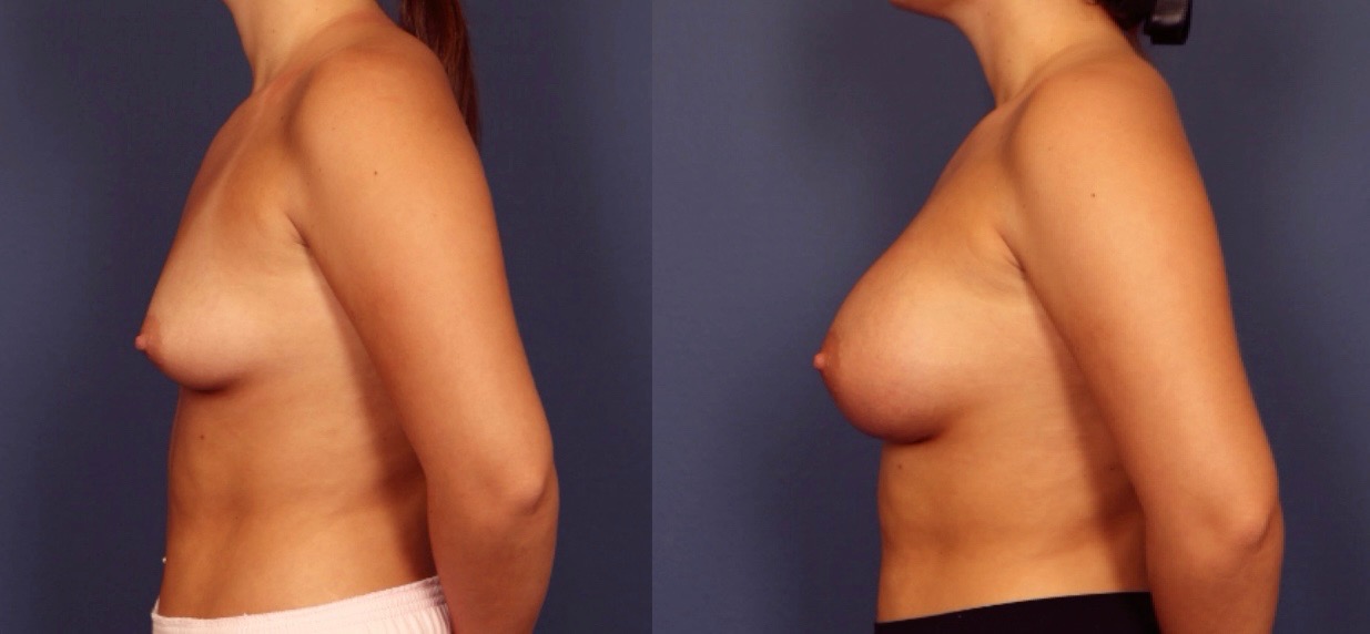 Before and After Image