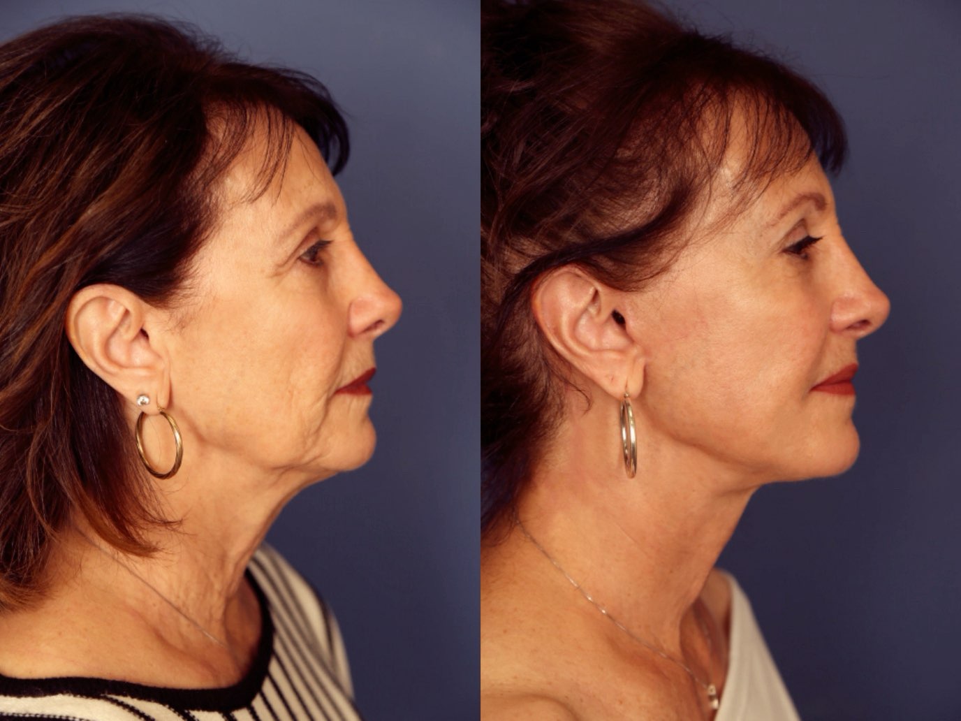 Before and After Image