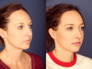 Before and After Image