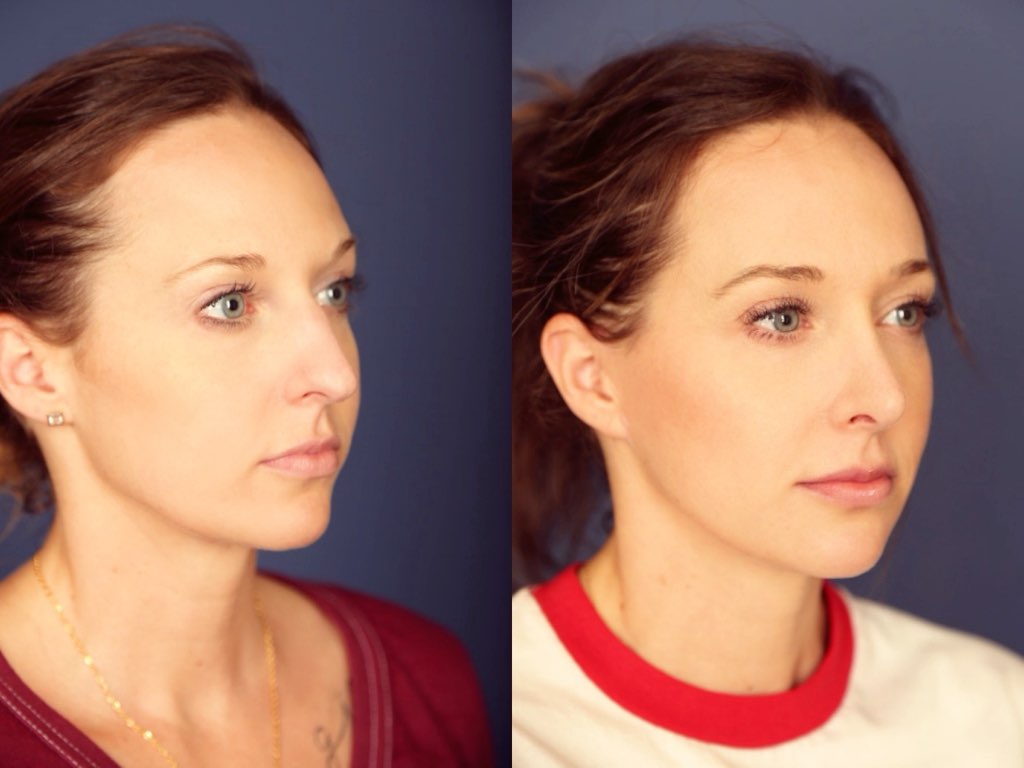 Before and After Image