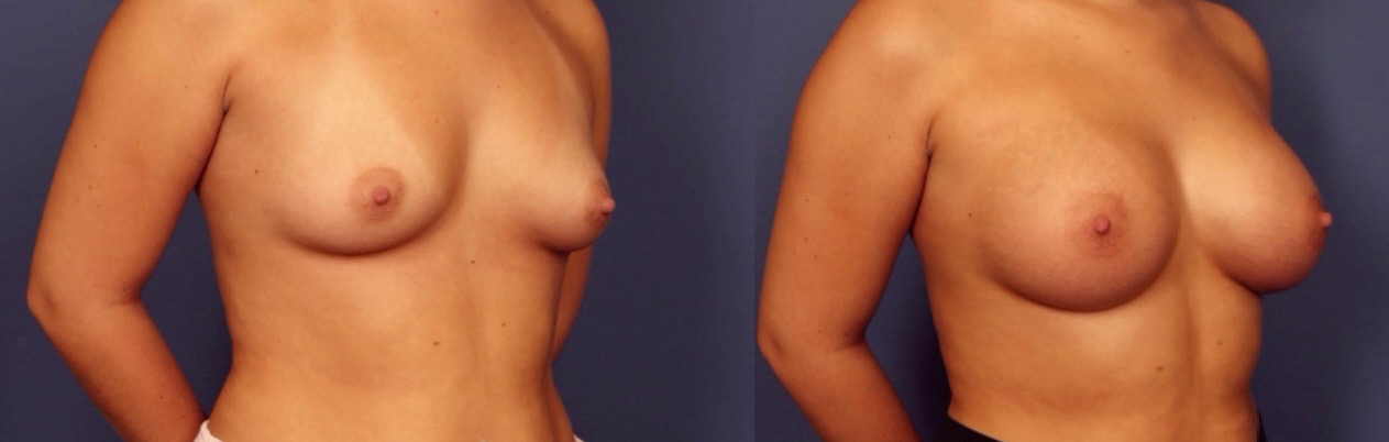 Before and After Image