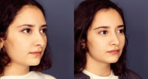 Before and After Image