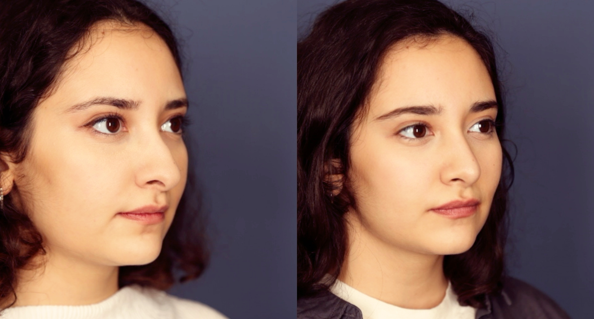 Before and After Image