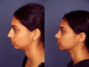 Before and After Image