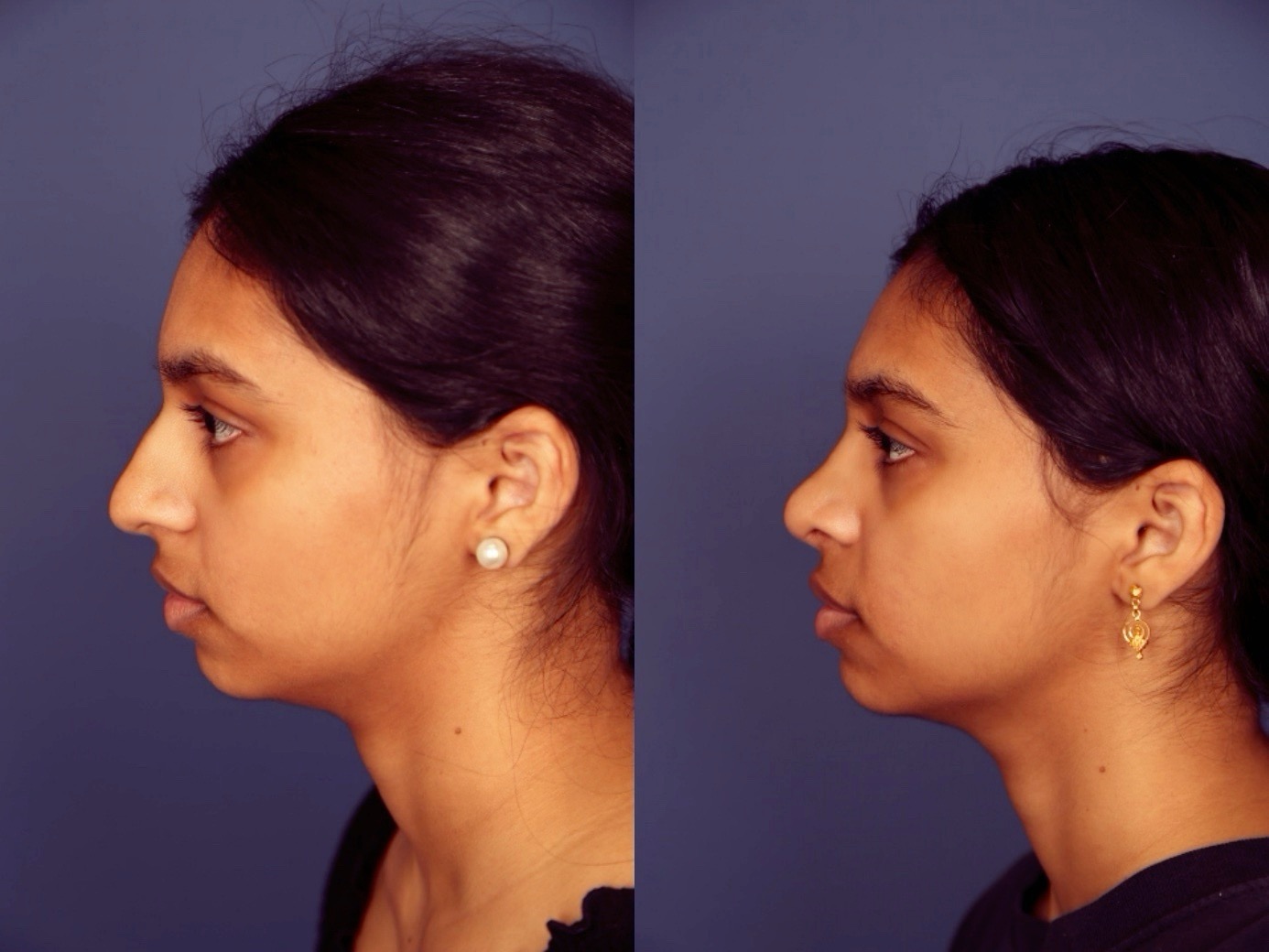 Before and After Image