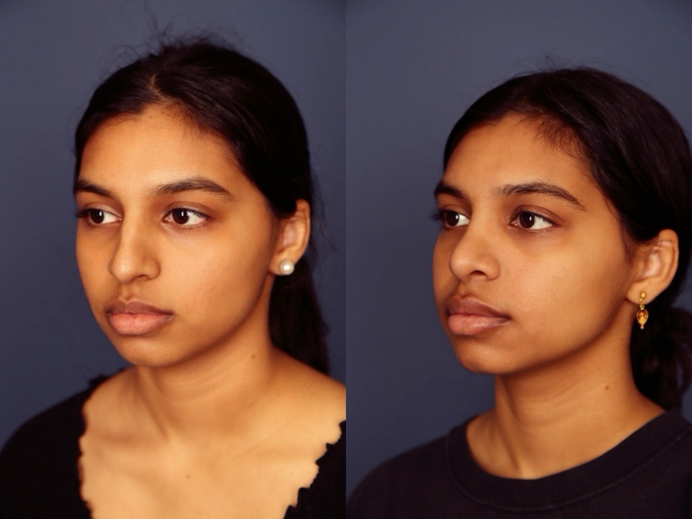 Before and After Image