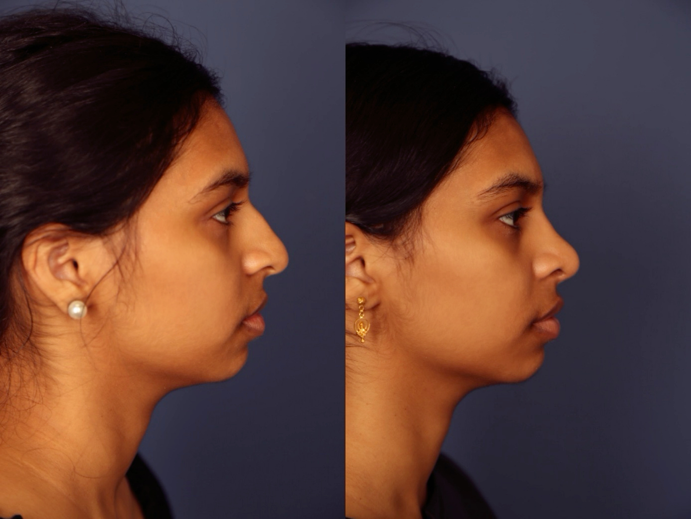 Before and After Image