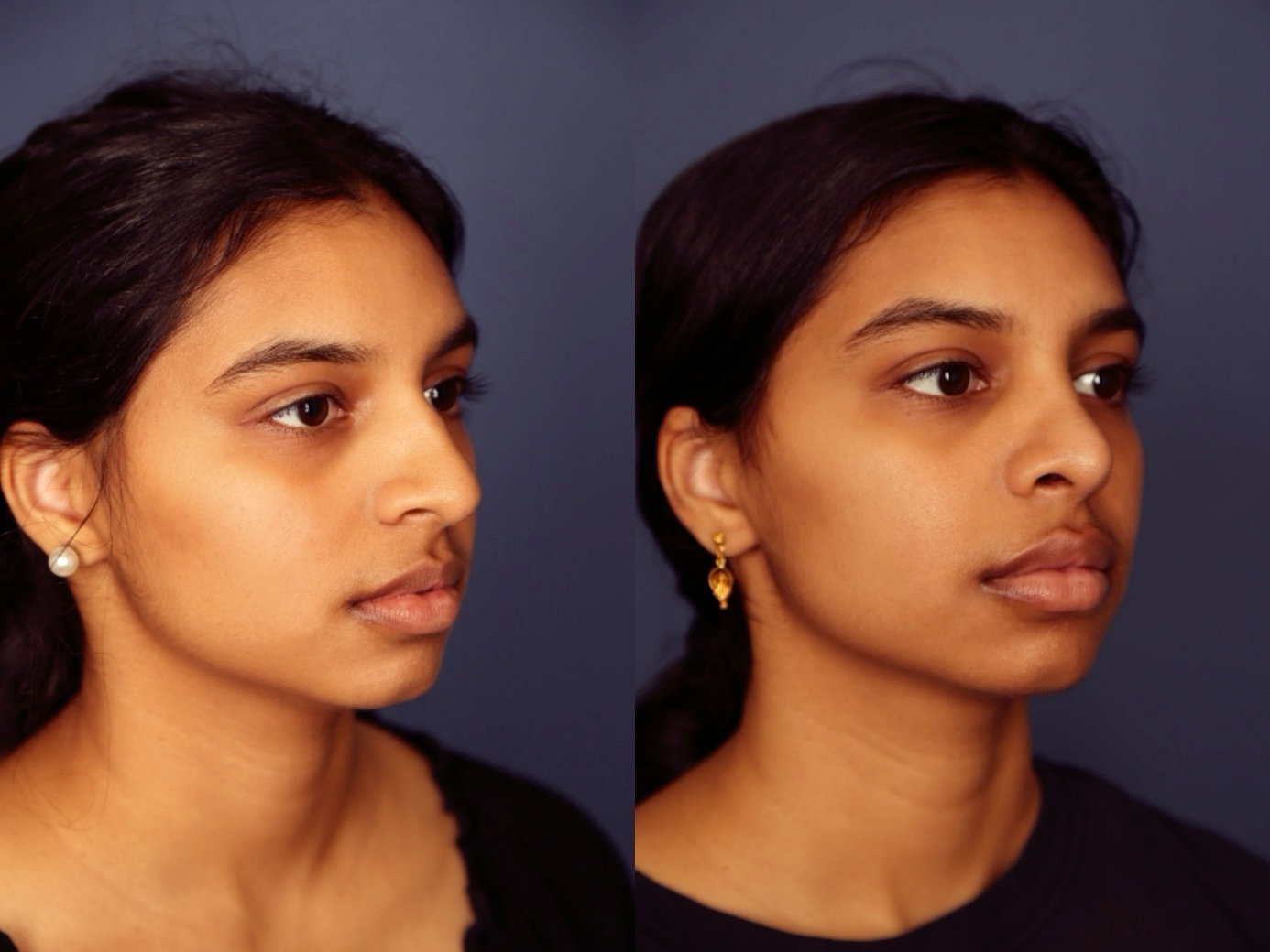 Before and After Image