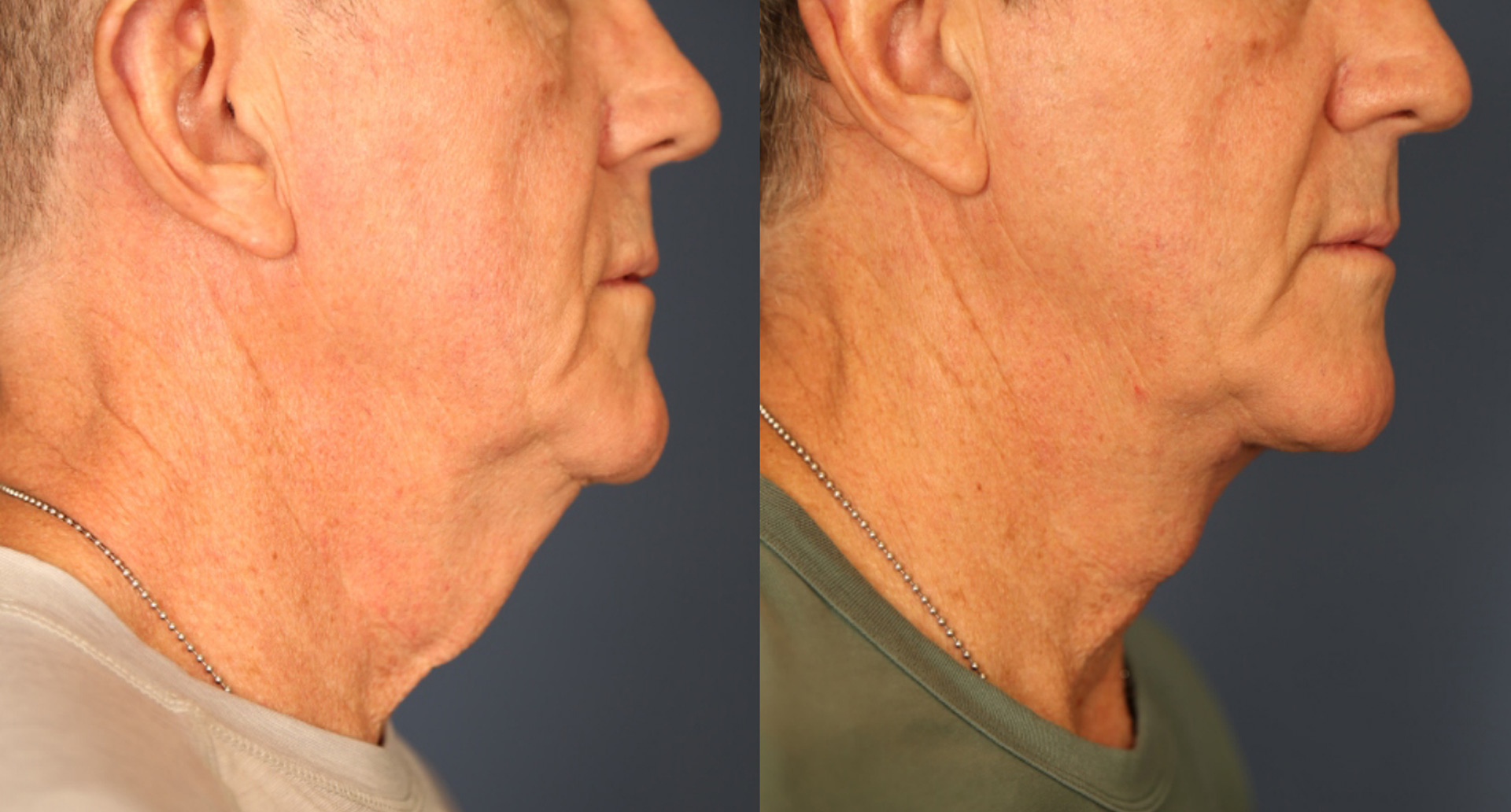 Before and After Image