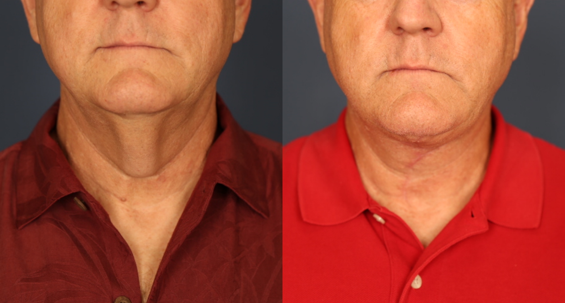 Before and After Image