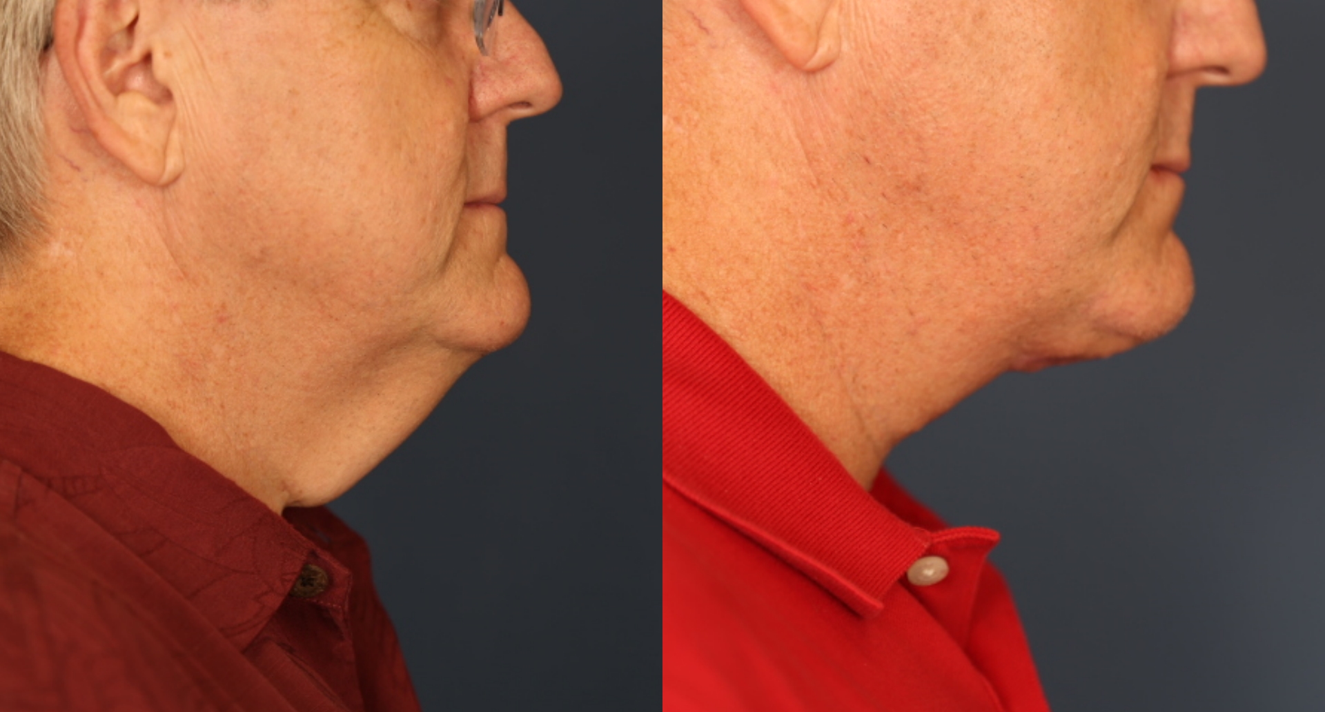 Before and After Image