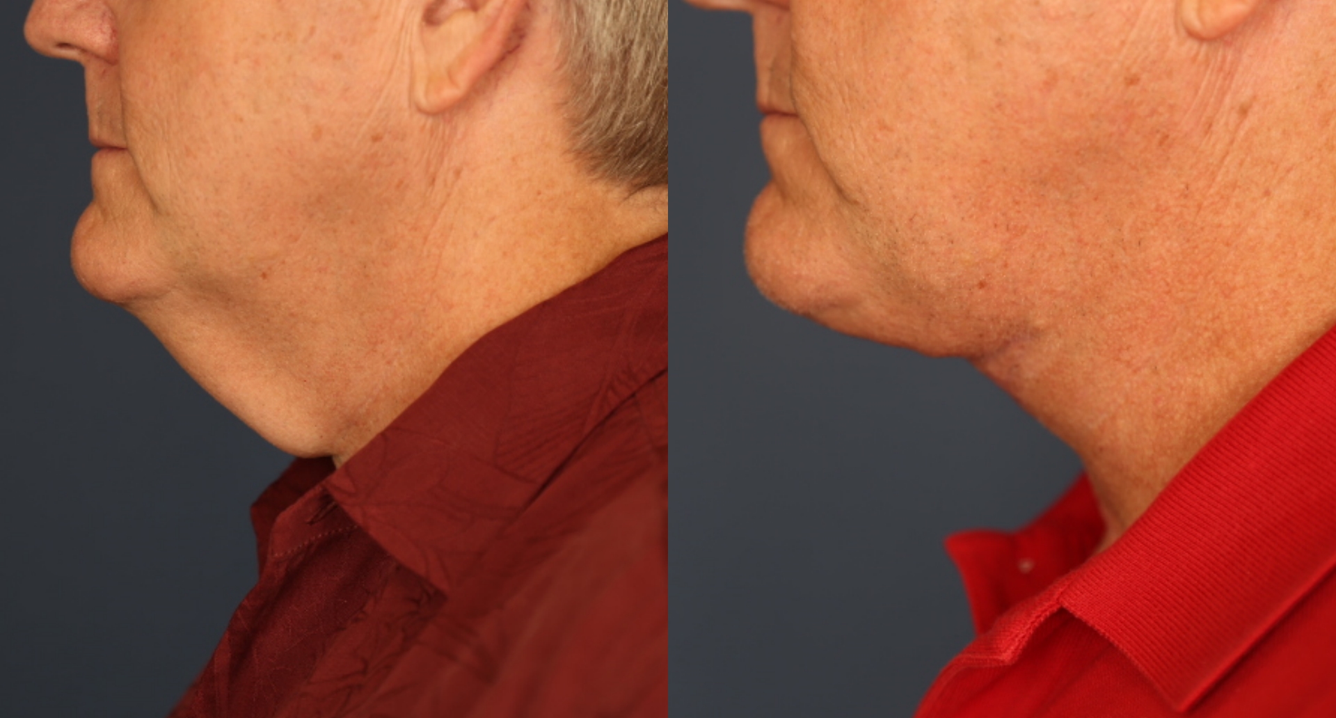 Before and After Image