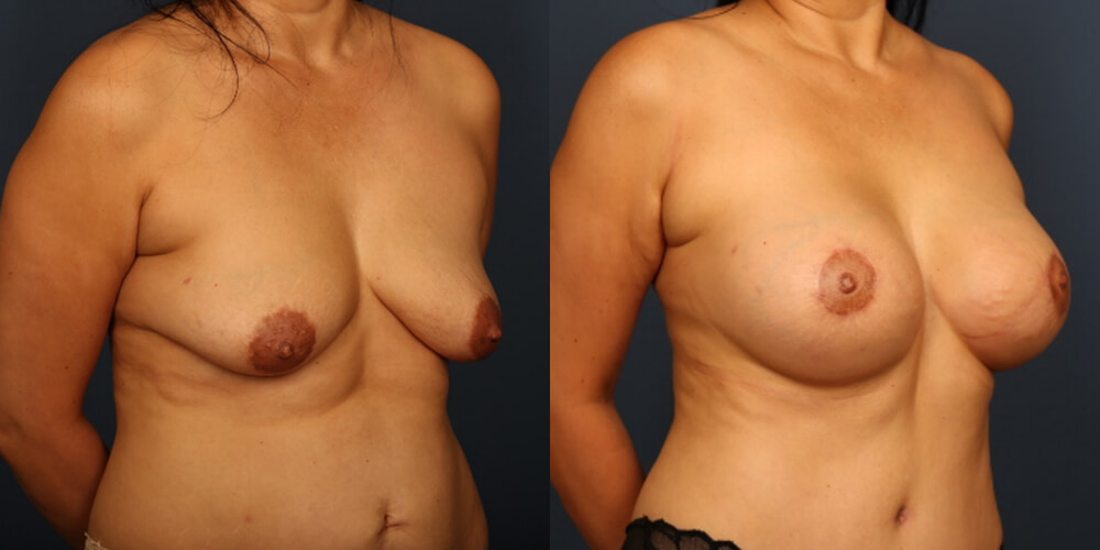 Before and After Image