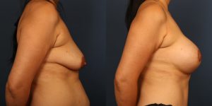 Before and After Image