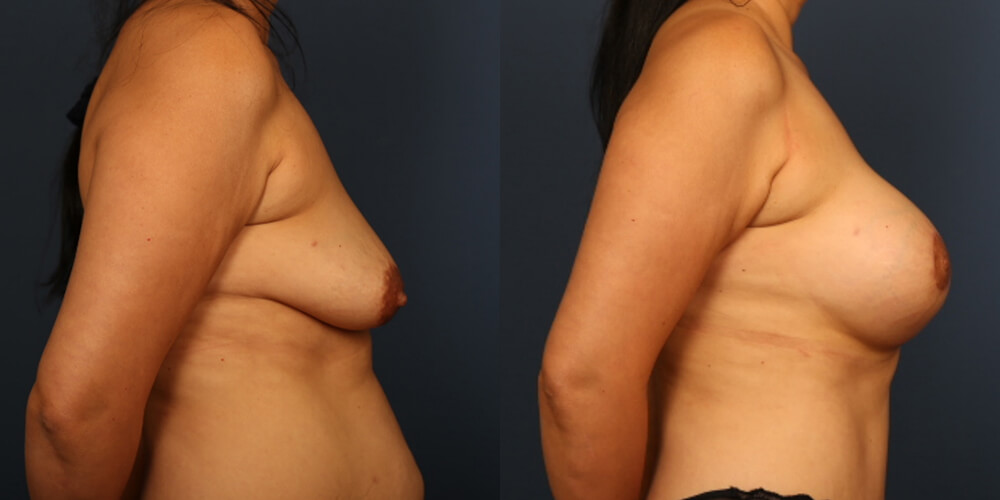 Before and After Image