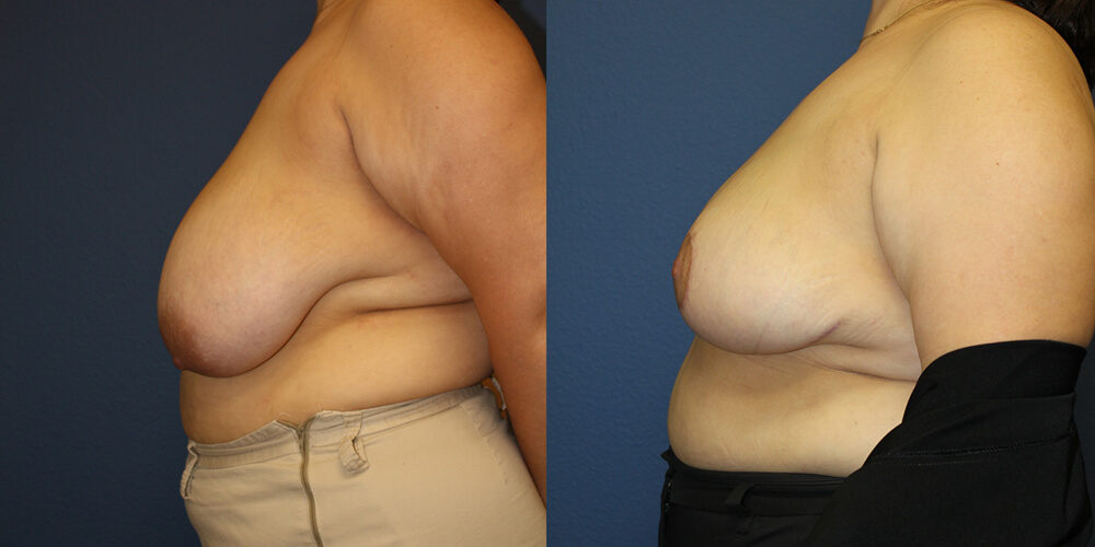 Before and After Image