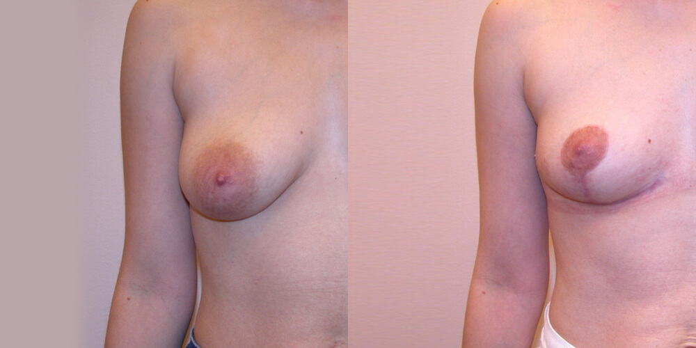 Before and After Image