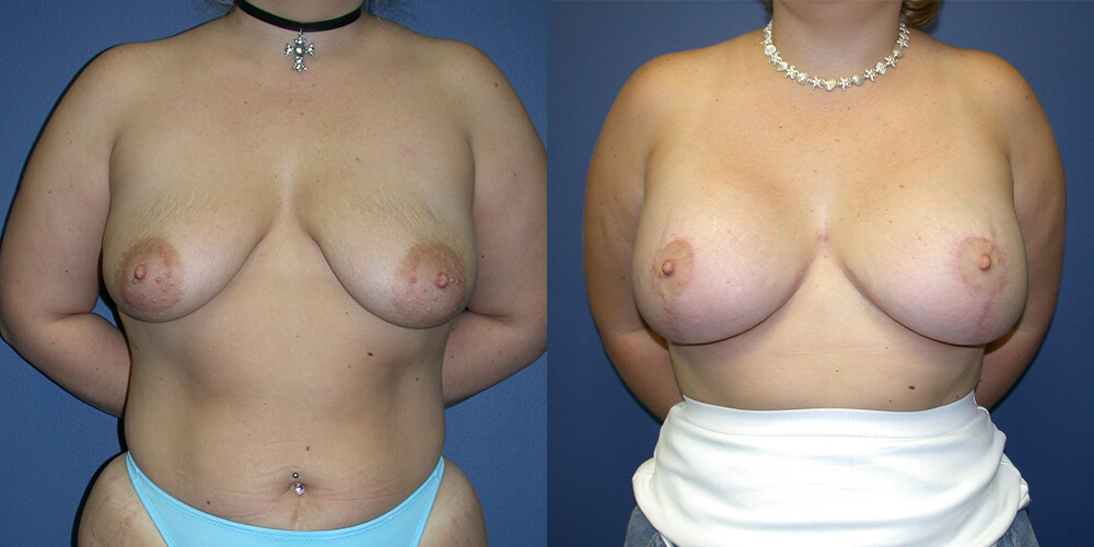 Before and After Image