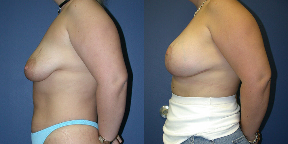 Before and After Image