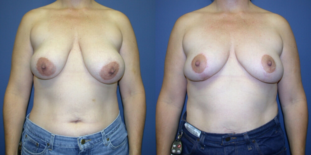 Before and After Image