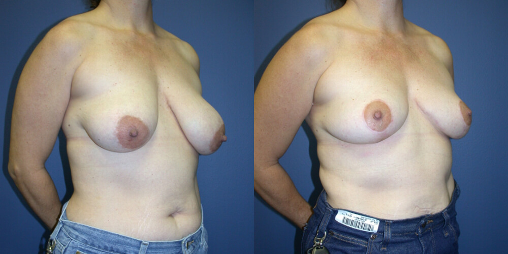 Before and After Image