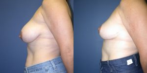 Before and After Image