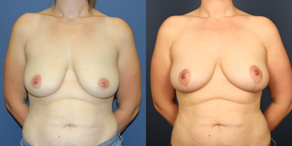 Before and After Image