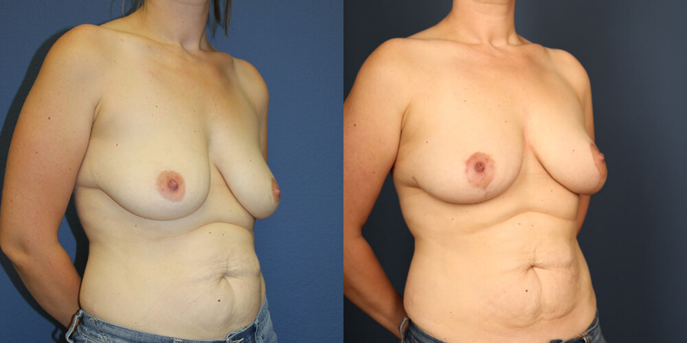 Before and After Image