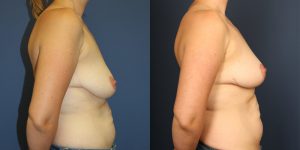 Before and After Image