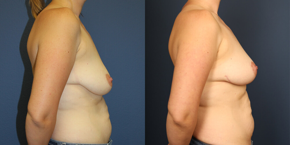 Before and After Image