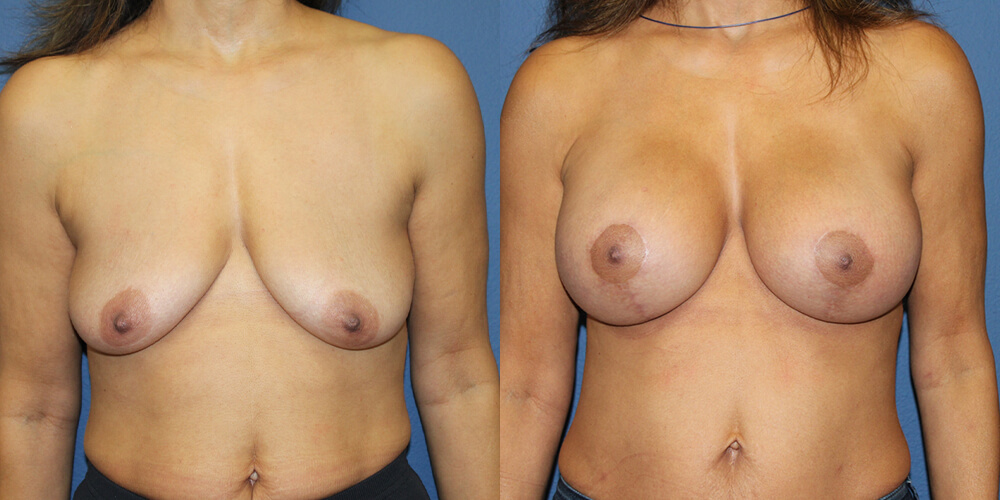 Before and After Image