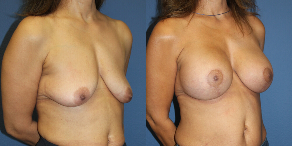 Before and After Image