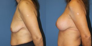 Before and After Image