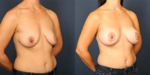 Before and After Image