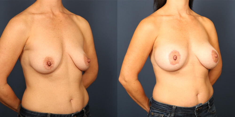 Before and After Image