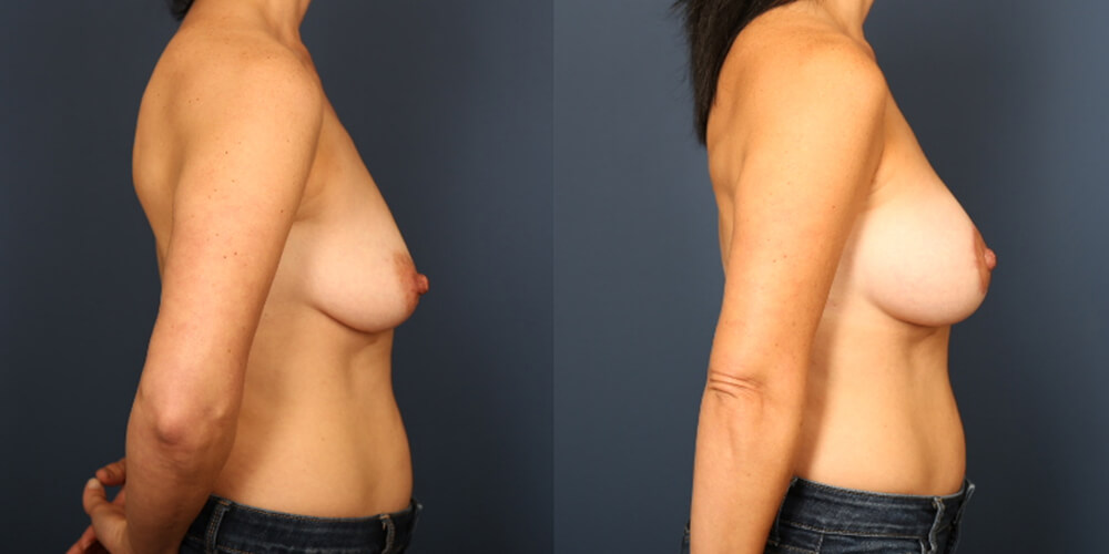 Before and After Image