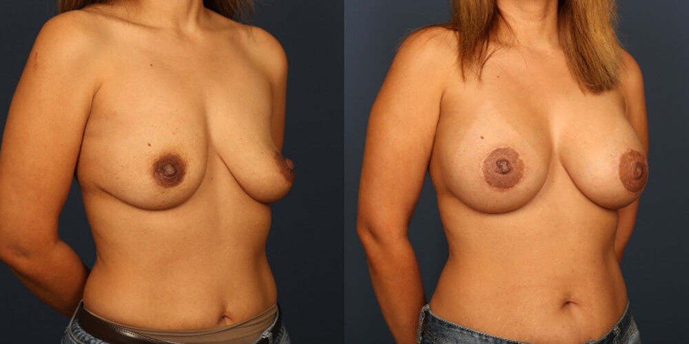 Before and After Image