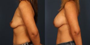 Before and After Image