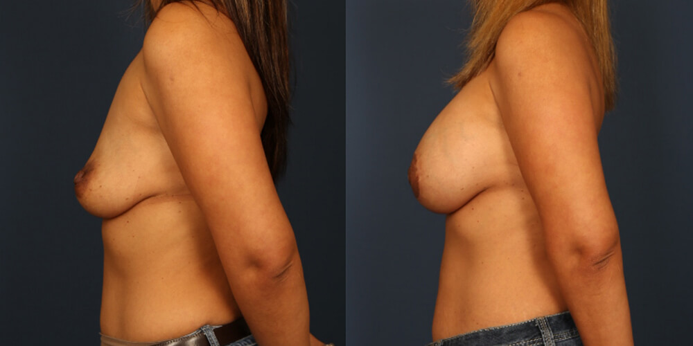 Before and After Image